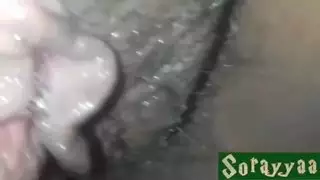 كس شعر جدا